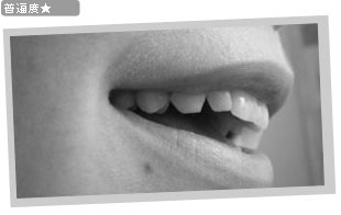 ���̒��̌�mouth